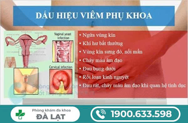 Hình ảnh minh họa